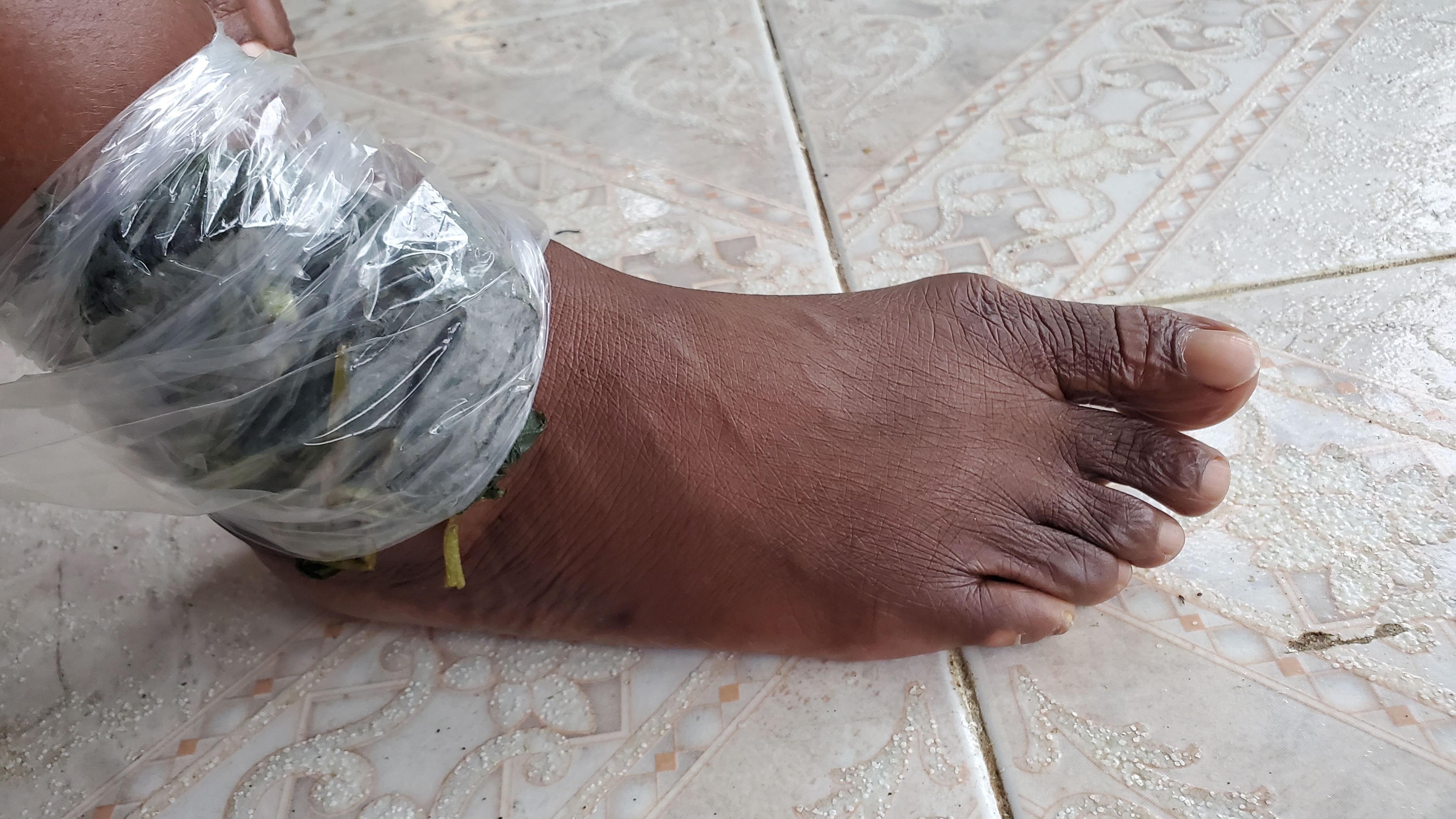 jamaican_comfrey_pain